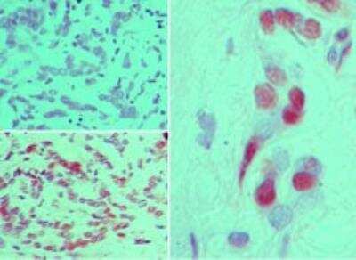 Immunohistochemistry-Paraffin: FGFR1 [p Tyr651, p Tyr652] Antibody [NBP2-24462]